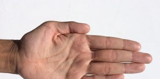 Przesuszająca się skóra dłoni