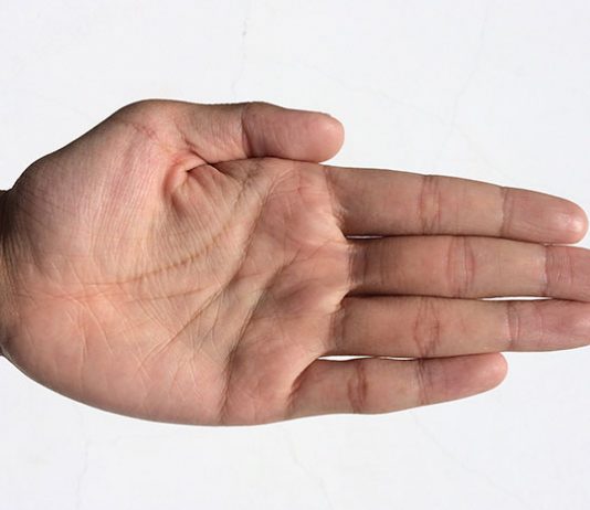 Przesuszająca się skóra dłoni
