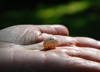 Co zrobić gdy boli ręka w nadgarstku?